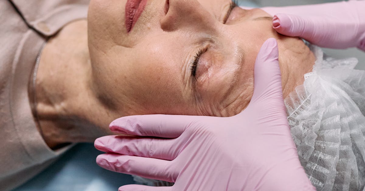 Common Misconceptions About Chemical Peels Debunked