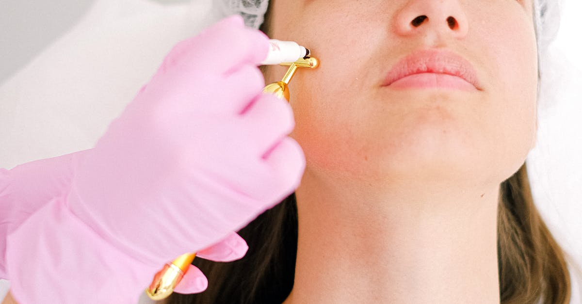 Common Myths About Chemical Peels Debunked