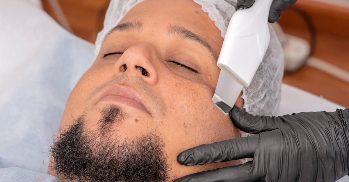 Post-Chemical Peel Care: Essential Tips for Recovery